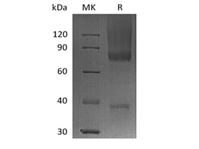 Recombinant Human Glypican-3/GPC3/OCI5 (C-6His-Avi) Biotinylated - ABMIUM