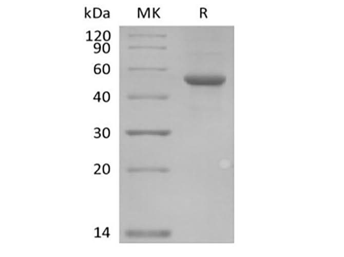 Recombinant Human ILDR2 (C-Fc) - ABMIUM