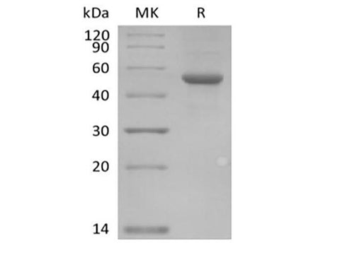 Recombinant Human ILDR2 (C-Fc) - ABMIUM