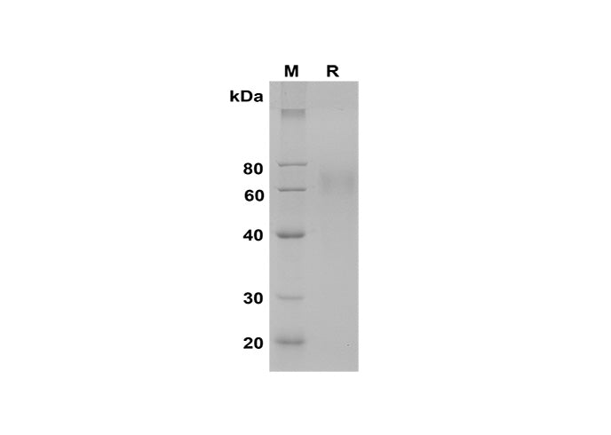 SDS-PAGE analysis of Porcine IGHE proteins, 2 μg/lane of Recombinant Porcine IGHE proteins was resolved with SDS-PAGE under reducing conditions, showing bands at 60-70 kDa.