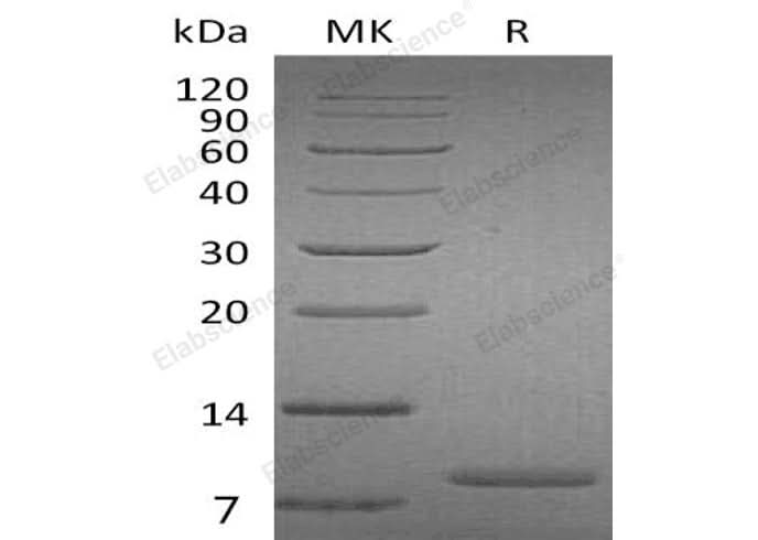Recombinant Human UGRP1 Protein - ABMIUM