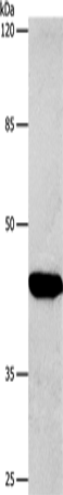 Anti-Human/Mouse/Rat CTGF Antibody - ABMIUM