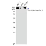 Western blot detection of Thrombospondin 1 in MCF-7,293T,C2C12 cell lysates using Thrombospondin 1 Rabbit mAb(1:1000 diluted).Predicted band size:130kDa.Observed band size:170kDa.