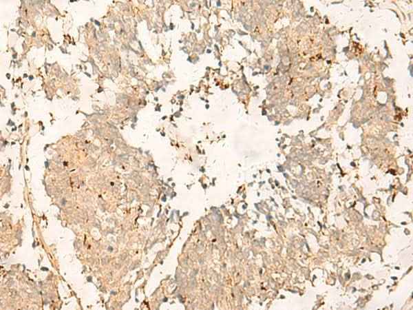 Anti-Human TEX11 Antibody