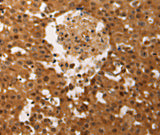 Anti-Human/Mouse/Rat JUND Antibody - ABMIUM