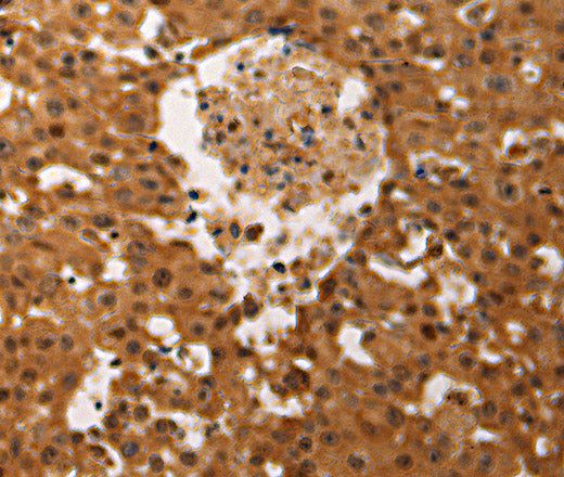 Anti-Human/Mouse/Rat JUND Antibody - ABMIUM