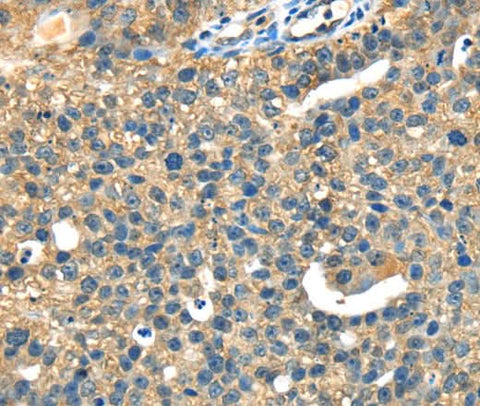 Anti-Human/Mouse/Rat DHCR24 Antibody - ABMIUM