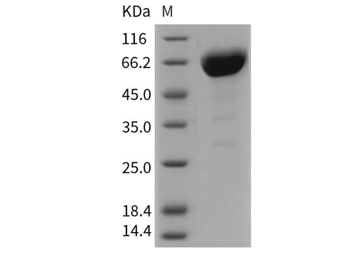 Recombinant Mouse CD147/Basigin Protein (His & Fc Tag) - ABMIUM
