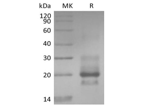 Recombinant Human TRAIL R1 / DR4 / TNFRSF10A (C-6His） - ABMIUM