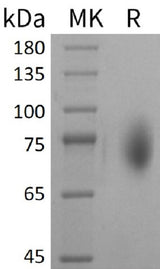 Recombinant Mouse CD86/B7-2 Protein (Fc Tag) - ABMIUM