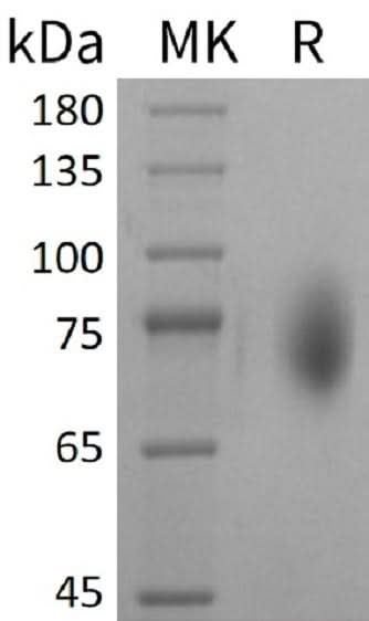 Recombinant Mouse CD86/B7-2 Protein (Fc Tag) - ABMIUM