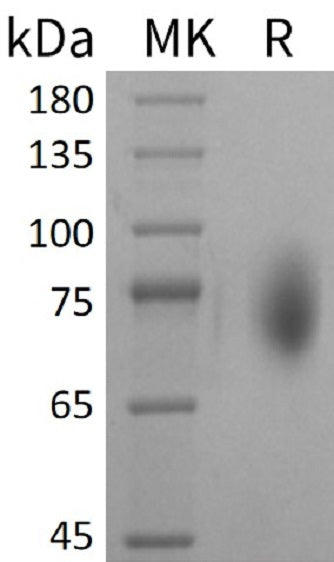 Recombinant Mouse CD86/B7-2 Protein (Fc Tag) - ABMIUM