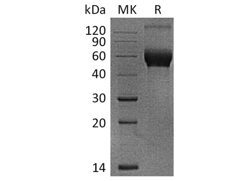 Recombinant Human IL-1R8/IL1RAPL1 Protein (His Tag) - ABMIUM