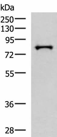 Western blot analysis of HepG2 cell lysate using PRPF3 Polyclonal Antibody at dilution of 1:2000