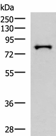 Western blot analysis of HepG2 cell lysate using PRPF3 Polyclonal Antibody at dilution of 1:2000