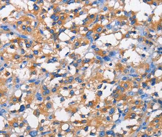 Anti-Human/Mouse/Rat PFKP Antibody