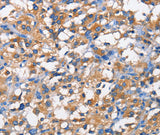 Anti-Human/Mouse/Rat PFKP Antibody - ABMIUM