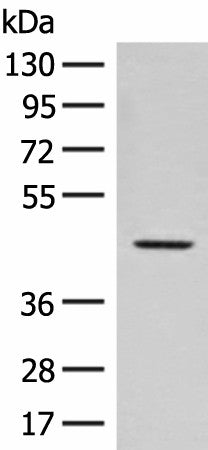 Anti-Human/Mouse FAM50A Antibody - ABMIUM