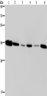 Anti-Human EMD Antibody - ABMIUM