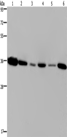 Anti-Human EMD Antibody - ABMIUM