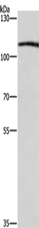Anti-Human/Mouse/Rat COPB1 Antibody - ABMIUM