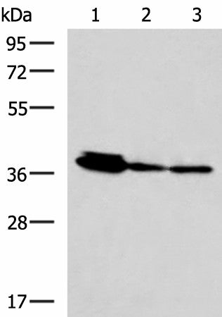 Western blot analysis of HepG2 A172 and A549 cell lysates using EEF1D Polyclonal Antibody at dilution of 1:800