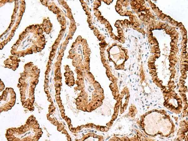Anti-Human/Mouse SAXO2 Antibody