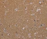 Anti-Human MAGEL2 Antibody - ABMIUM