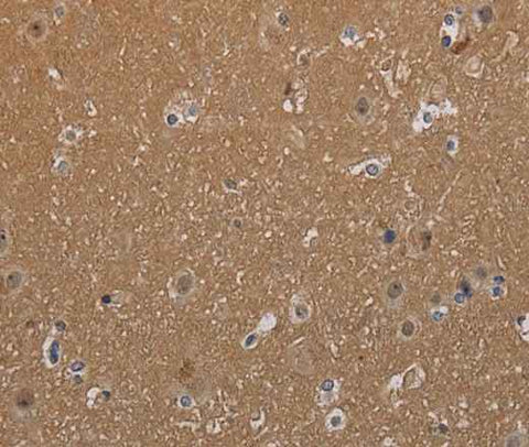 Anti-Human MAGEL2 Antibody