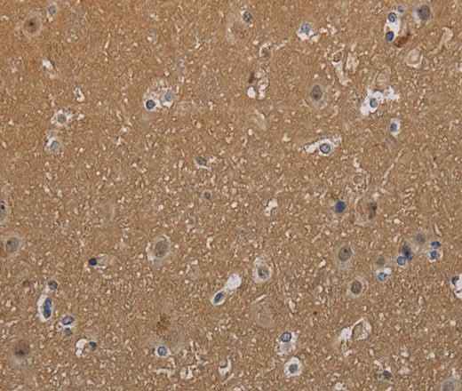 Anti-Human MAGEL2 Antibody