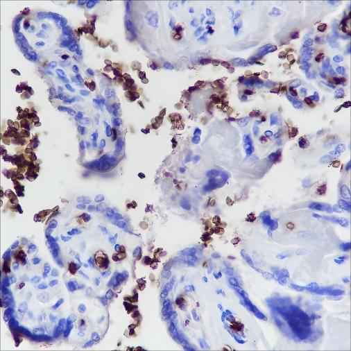 Anti-Human Glycophorin A Antibody [A231] - ABMIUM
