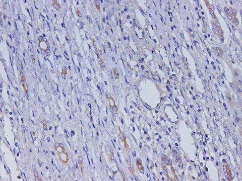 Anti-Human AFP Antibody - ABMIUM