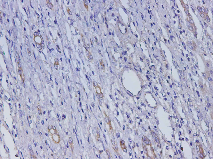 Anti-Human AFP Antibody - ABMIUM