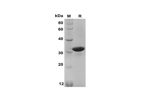 SDS-PAGE analysis of Human NPY proteins, 2 μg/lane of Recombinant Human NPY proteins was resolved with SDS-PAGE under reducing conditions, showing bands at 31 kDa.
