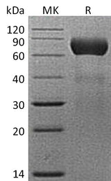 Recombinant Mouse NTPDase 2/ENTPD2 Protein (His Tag) - ABMIUM