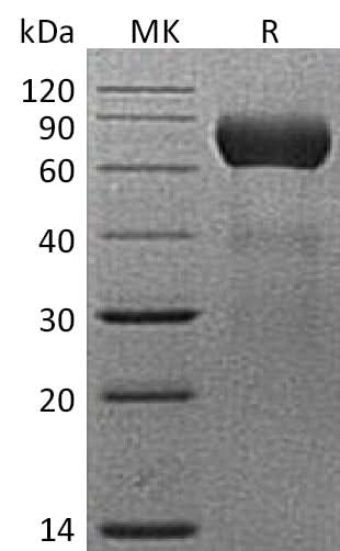 Recombinant Mouse NTPDase 2/ENTPD2 Protein (His Tag) - ABMIUM