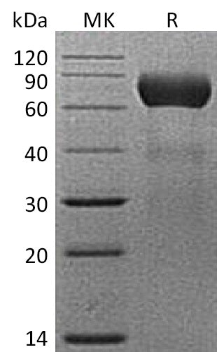 Recombinant Mouse NTPDase 2/ENTPD2 Protein (His Tag) - ABMIUM