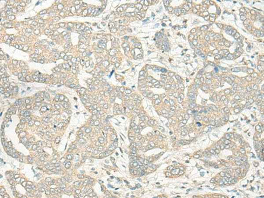 Anti-Human HLA-DRB5 Antibody