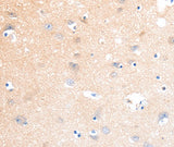 Anti-Human/Mouse/Rat SLC22A17 Antibody - ABMIUM