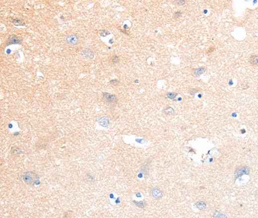 Anti-Human/Mouse/Rat SLC22A17 Antibody
