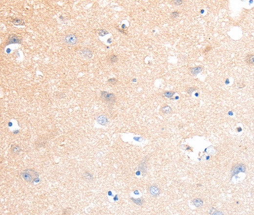 Anti-Human/Mouse/Rat SLC22A17 Antibody - ABMIUM
