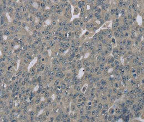 Anti-Human EDN1 Antibody