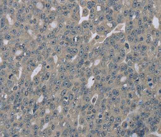 Anti-Human EDN1 Antibody