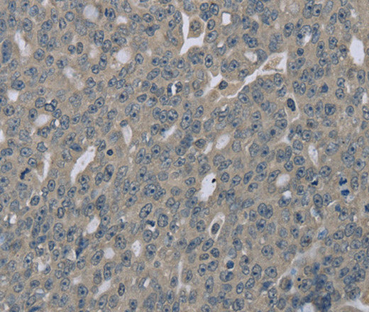 Anti-Human EDN1 Antibody - ABMIUM