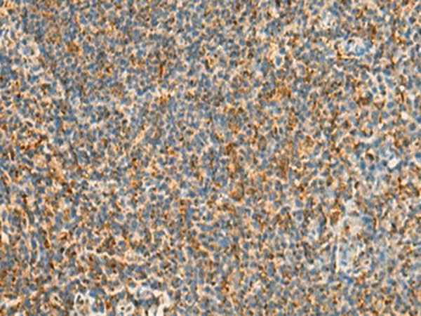 Anti-Human/Mouse STK32C Antibody