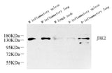 Western Blot analysis of various samples using JAK2 Polyclonal Antibody at dilution of 1:1000.