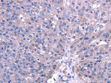 Anti-Human TRIM49 Antibody - ABMIUM
