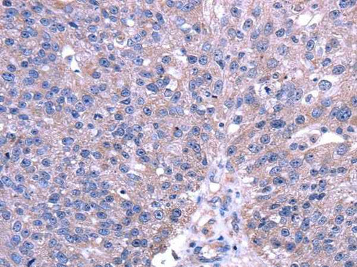 Anti-Human TRIM49 Antibody