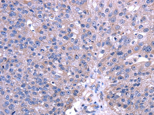 Anti-Human TRIM49 Antibody - ABMIUM