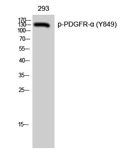 Western Blot analysis of 293 cells with Phospho-PDGFRA (Tyr849) Polyclonal Antibody